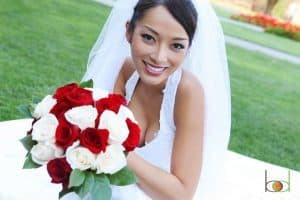 3 Reasons Brides Should Consider Laser Hair Removal Before the Big